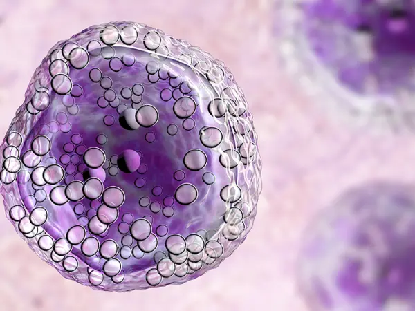 Mantle cell lymphomas