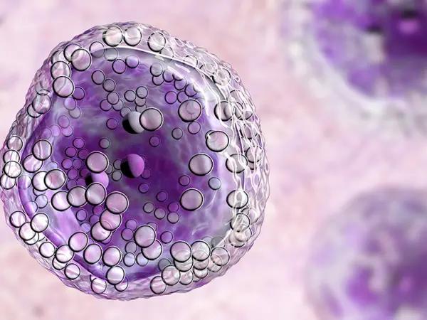 Mantle cell lymphomas