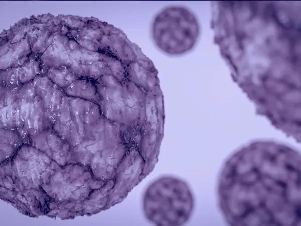 Mature T and NK cell neoplasms